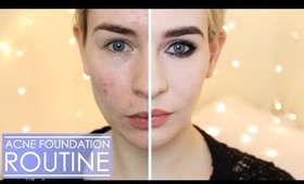 DRUGSTORE ACNE FOUNDATION ROUTINE