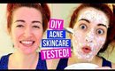 HOW TO: Remove Dry Flaky Skin & Acne Using OATMEAL?! 1 CENT DIY Homemade Skincare!