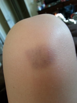 I found some purple eyeshadows and made a fake bruise.....it was quite fun actually. 