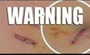 WARNING: GRAPHIC CONTENT - My Skin Cancer Scare