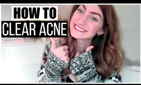 HOW TO CLEAR ACNE