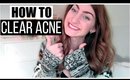HOW TO CLEAR ACNE