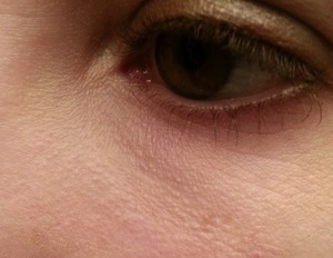 Has anyone used retinol treatments? | Beautylish