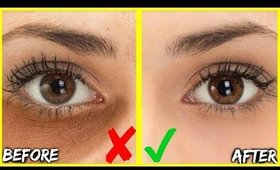 HOW TO GET RID OF DARK UNDER EYE CIRCLES & BAGS IN DAYS! BEST 3 OILS FOR EYE WRINKLES & PUFFY EYES!