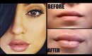 How to Get Kylie Jenner BIGGER, Fuller, Plumper Lips in 2 Minutes without Injections │ CANDYLIPZ