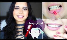 تبييض الاسنان في المنزل في ثلاث ايام! شوفو النتيجة! | How to Whiten teeth at home