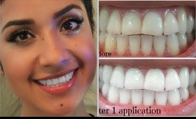 My Oral Hygiene + How I Keep a White Smile