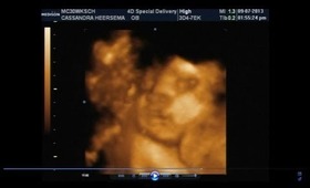 30 weeks ulstrasound