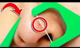 6 Clever Tricks To Unclog Pores INSTANTLY!