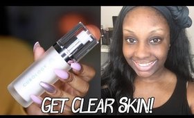 How I Got My Skin in the Best Shape Ever! | Makeupd0ll