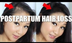 HOW TO HIDE POSTPARTUM HAIR LOSS!