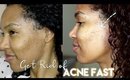 How I Got Rid of My Acne in 7 Days | 6 Tips to Get Clear Skin