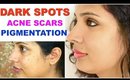 Dark Spots, Acne Marks, Pigmentation | Get Flawless Skin | ShrutiArjunAnand