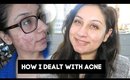 How to deal with acne my acne & feel confident my story
