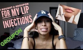 Story Time: I Bought A Groupon For My Lip Injections