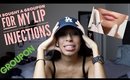 Story Time: I Bought A Groupon For My Lip Injections