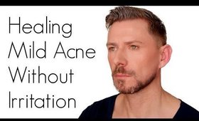 HOW TO TREAT ACNE WITHOUT IRRITATING YOUR SKIN