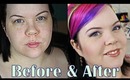 Cover Acne Scars & Rough Texture!!