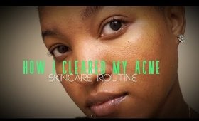 HOW I CLEARED MY ACNE SCARS//WEEKLY SKINCARE ROUTINE