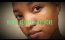 HOW I CLEARED MY ACNE SCARS//WEEKLY SKINCARE ROUTINE