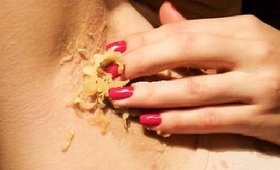How to Lighten Dark Underarms at Home? _ Naturally Get Rid of Dark Armpits | SuperWowStyle DIY