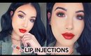 My Lip Injection Experience + Q&A