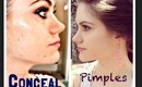 How to Conceal Pimples QUICK And EASY
