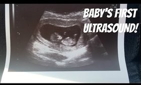 BABY'S FIRST ULTRASOUND / 12 WEEKS / VLOG