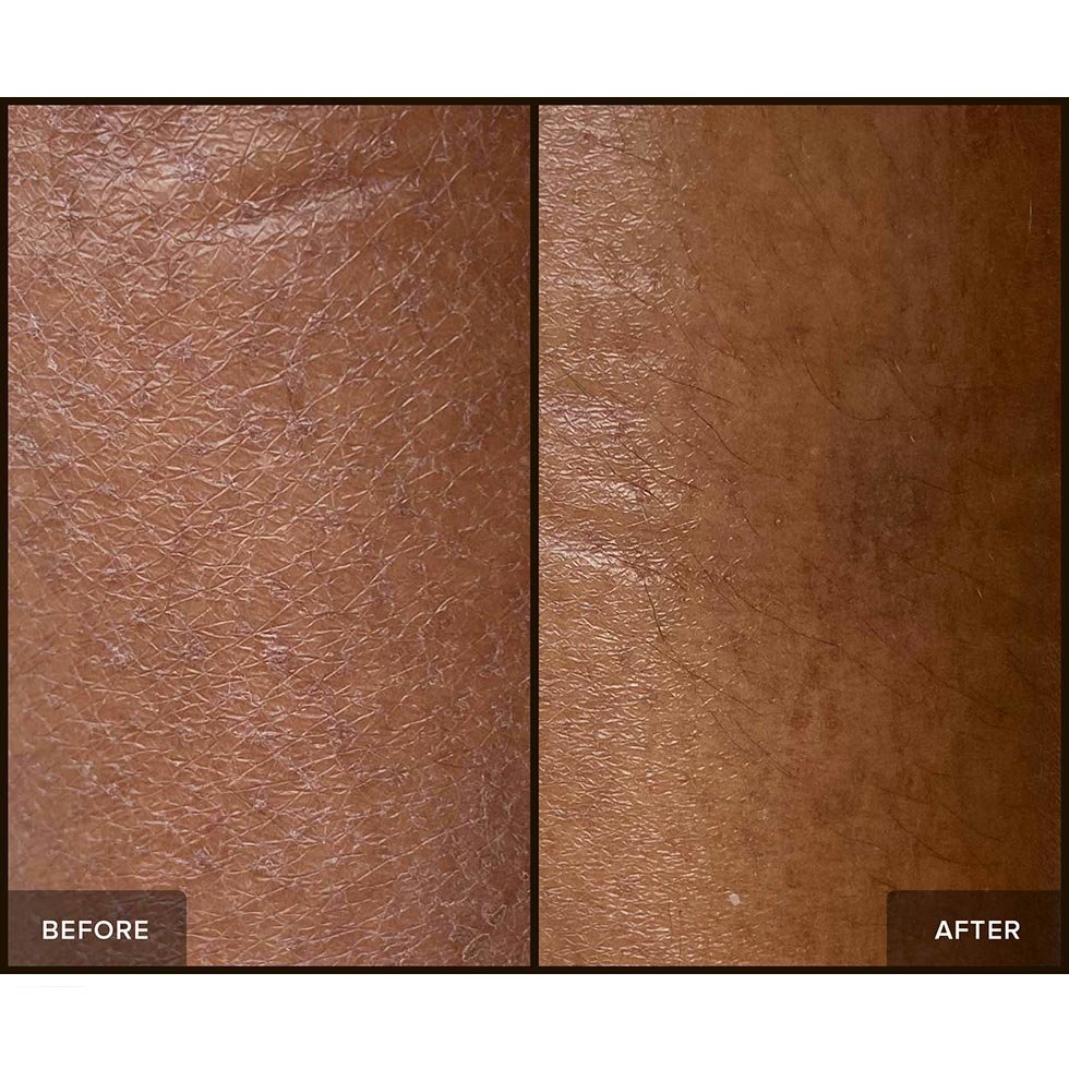 Nudestix NudeBody Peptide Body Creme Before & After