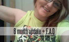 ♡ 6 Month Update + F.A.Q: Spinal Cord Injury ♡