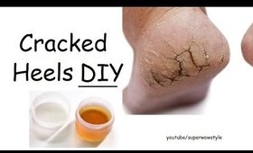 DIY cracked heels remedy | superwowstyle