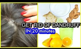 In 20 Minutes How To Clear DANDRUFF & ITCHY SCALP Remedy | SuperPrincessjo