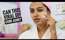 The MOST Viral DIY for ACNE - How to do this right? || Best Acne treatment & Pimple home remedy