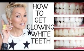 How I Whiten (Bleach) My Teeth