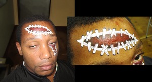Open Wound Done with paint..