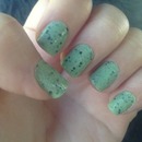 speckled nails