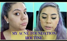 My Acne Foundation Routine!!