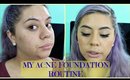 My Acne Foundation Routine!!