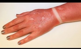 FX Makeup Series: First Degree Burn (Sunburn)