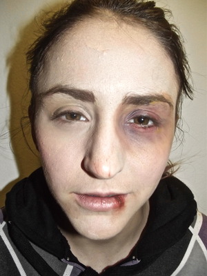 Fight victim, breakdown makeup. 