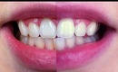 How to whiten your teeth at home quickly, (20 minutes)!