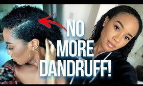 Relieve Itchy, Dry Scalp For Hair Growth | Fast + Effective