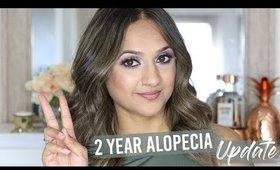 2 Year Alopecia Update