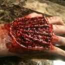 Hand wound