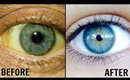 How To Whiten the Whites Of Your Eyes Naturally! │ Get Rid of Dull Yellow Eyes │Sparkling White Eyes