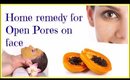 Beauty Tip Home remedy for Open Pores on face
