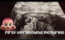 FINALLY SAW A DOCTOR!! Pregnancy Update & First Ultrasound Pictures!!!