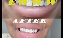 HOW TO WHITEN TEETH IN 7 DAYS?! + GIVEAWAY SMIILE BRILLIANT