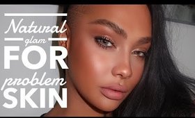 NATURAL GLAM FOR PROBLEM SKIN | SONJDRADELUXE