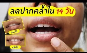 ทดลองใช้ลิปบาล์ม IRA ลดปากคล้ำใน 14 วัน? | Licktga